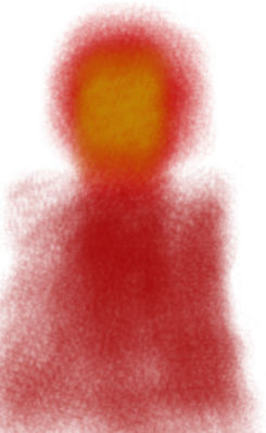 A thermographic image of... something.